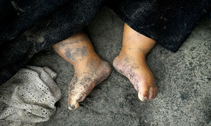 काठले च्यापिएर ४ वर्षीय बालकको मृत्यु