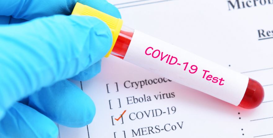 २४१ सङ्क्रमित थपिँदा निधन हुनेको सङ्ख्या शून्य