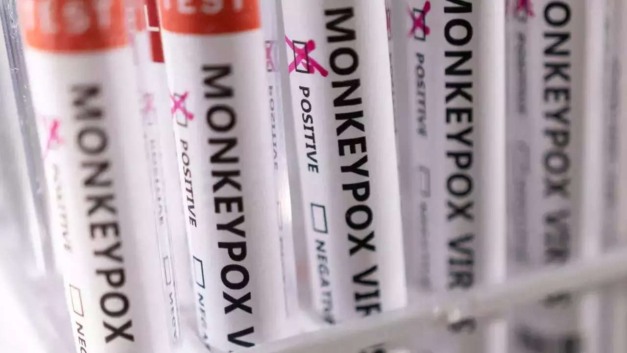 US reports over 1,000 monkeypox cases