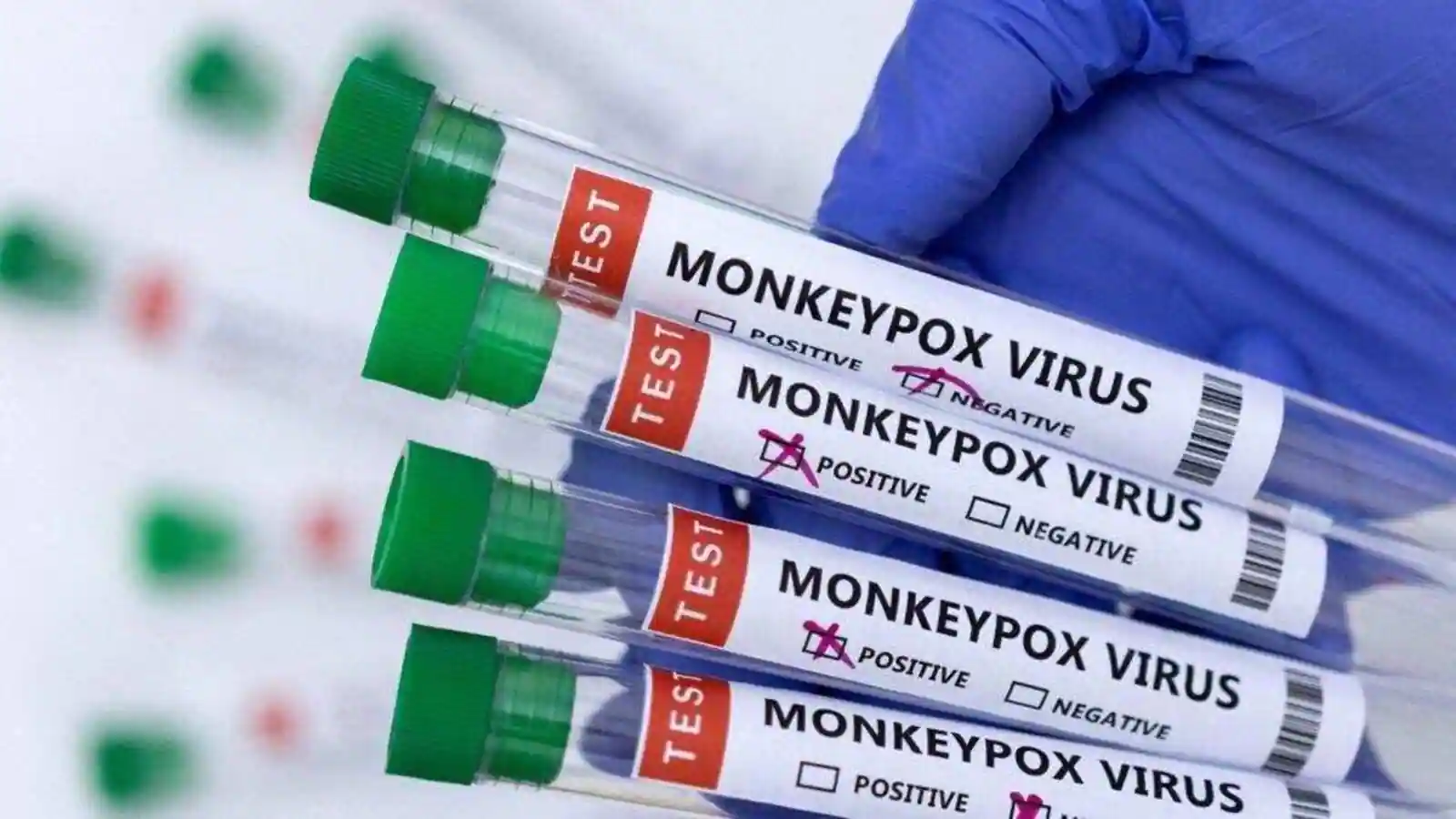 India reports sixth monkeypox case