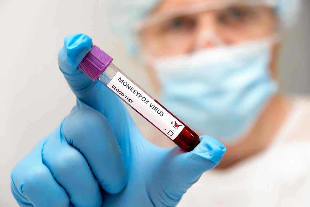 U.S. reports over 27,000 monkeypox cases